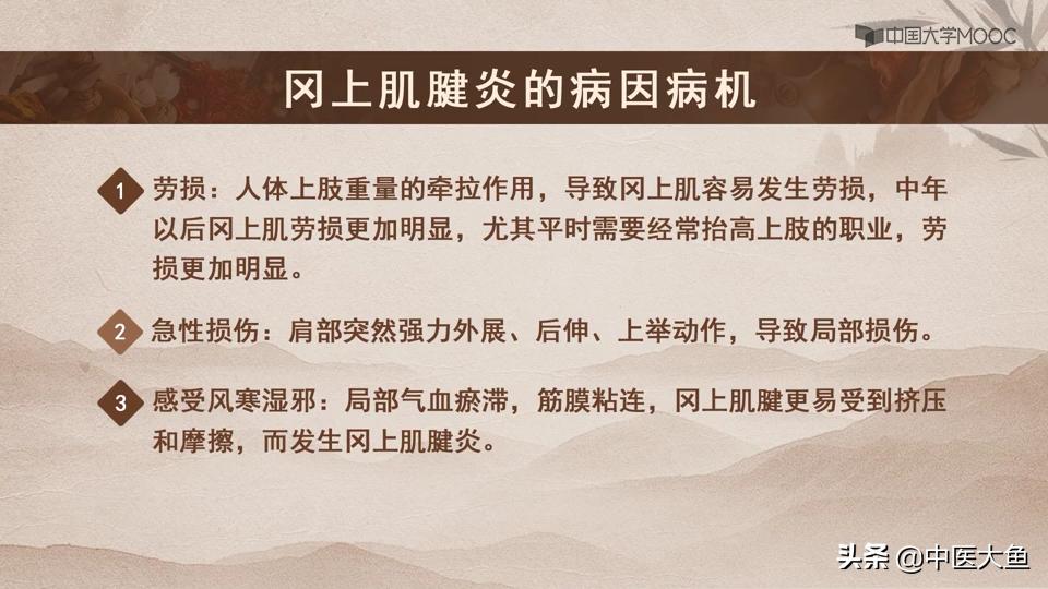 冈上肌腱炎的体征,冈上肌肌腱炎的症状及治疗