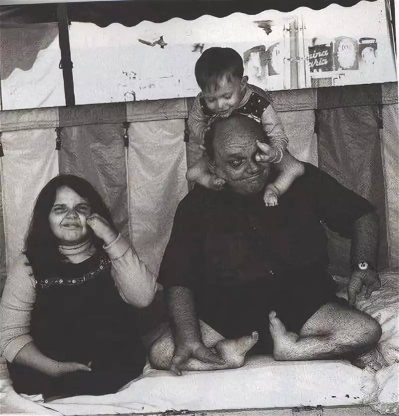 家暴谋杀却逍遥法外，先天畸形反而助长“龙虾男孩”的邪恶