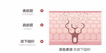 激光美白祛斑淡化斑点并去除皱纹,牙齿内源性变色用激光美白有用吗