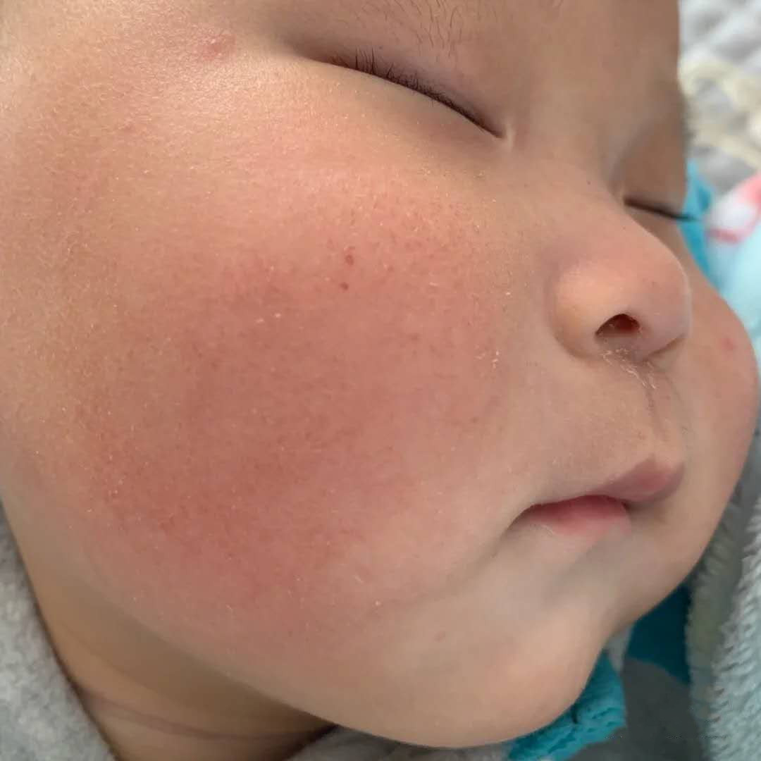 郁美净无硅油儿童面霜,郁美净为什么突然买不到了