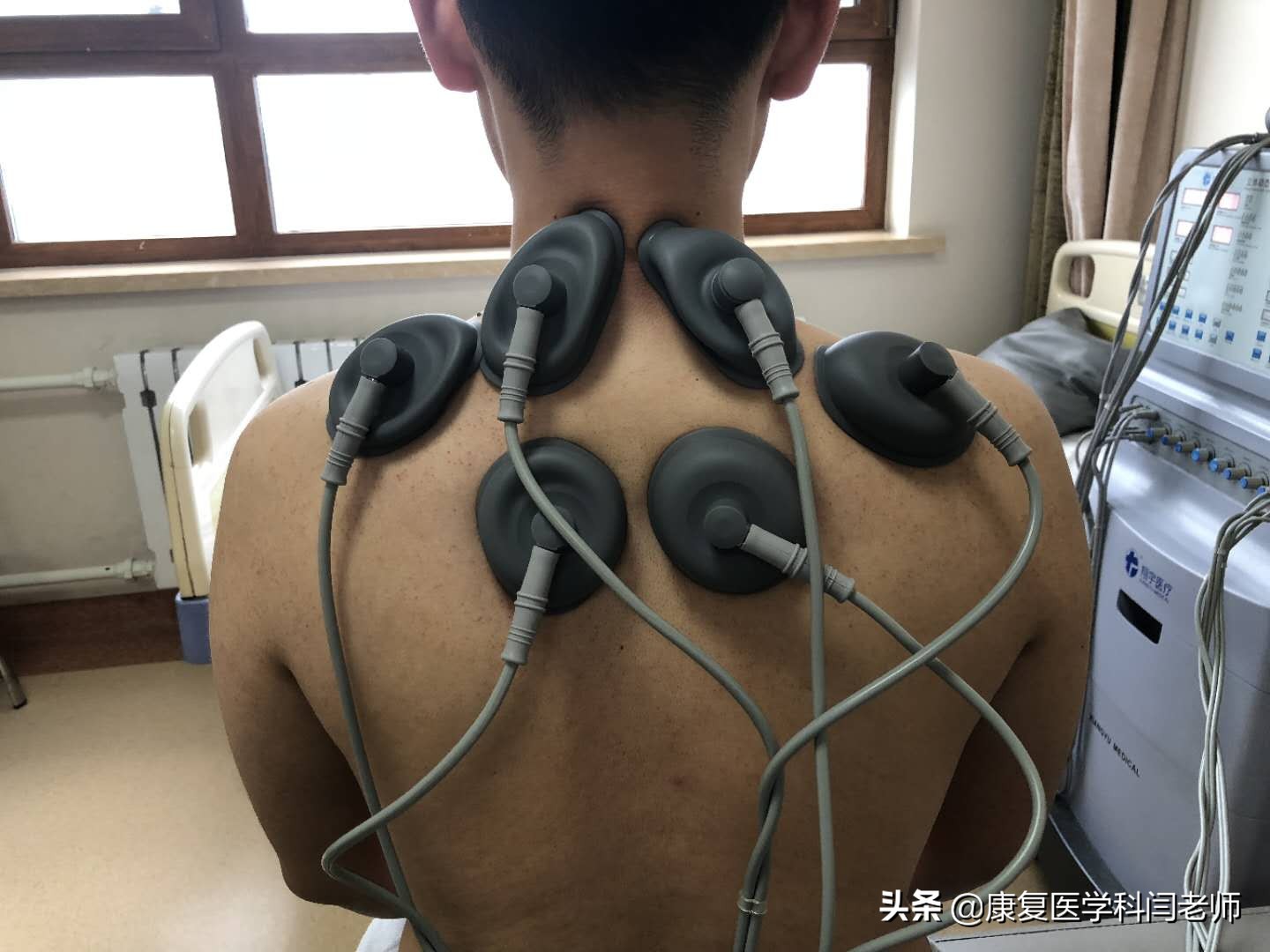 中频康复治疗,康复科中频脉冲治疗