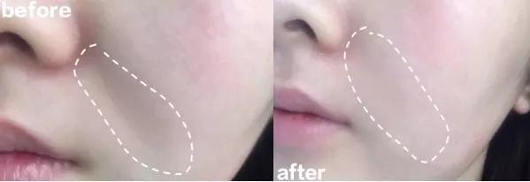 刘亦菲保养皮肤的方法,30岁皱纹多怎么修复