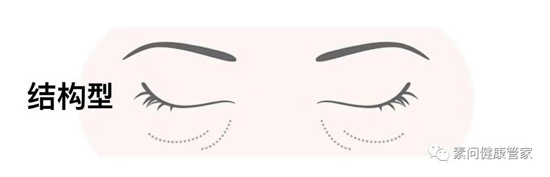 你的黑眼圈是天生的吗,化疗为什么有黑眼圈