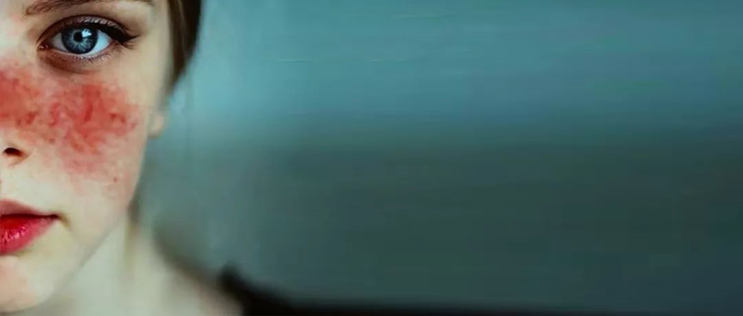 刷酸到底是拯救烂脸还是毁容,刷酸真的能让皮肤变好吗小心烂脸