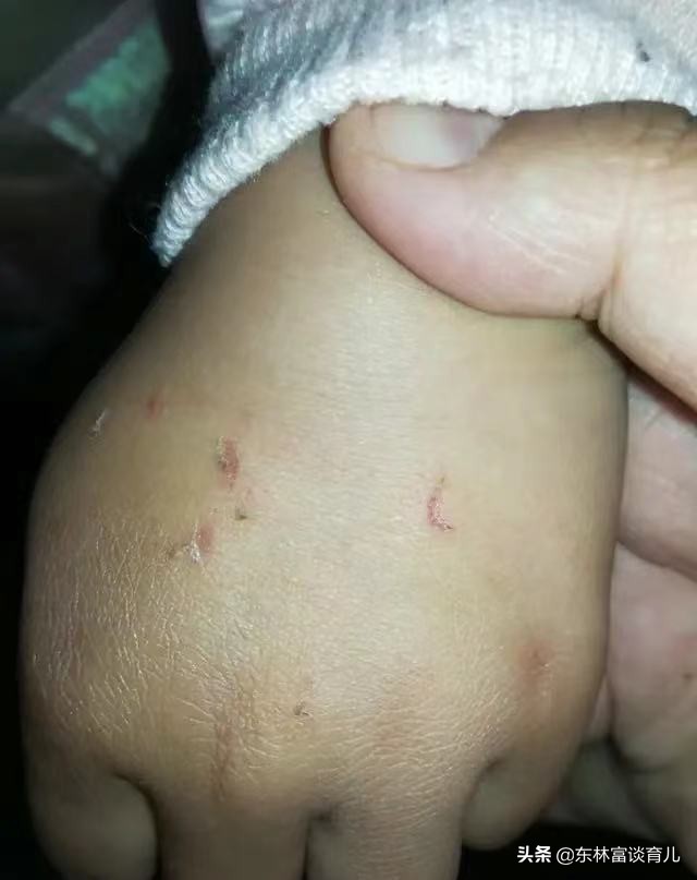 幼儿园孩子被打家长正确处理,小孩子在幼儿园被打该怎么处理