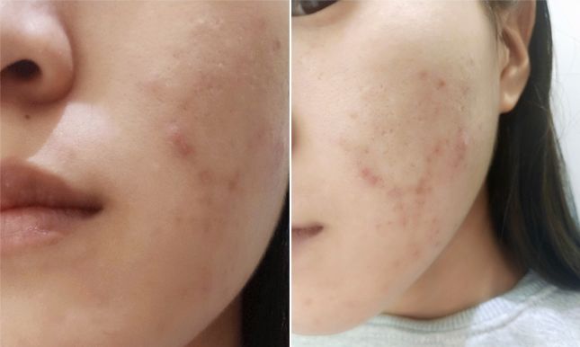 韩国drjart蒂佳婷药丸水乳测评,蒂佳婷bb霜经典银管bb霜