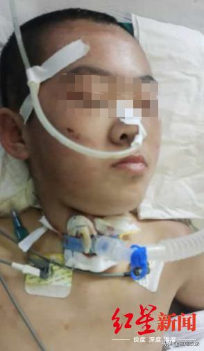 12岁女孩被继母虐待致脑梗死,女童疑遭继母虐待身亡