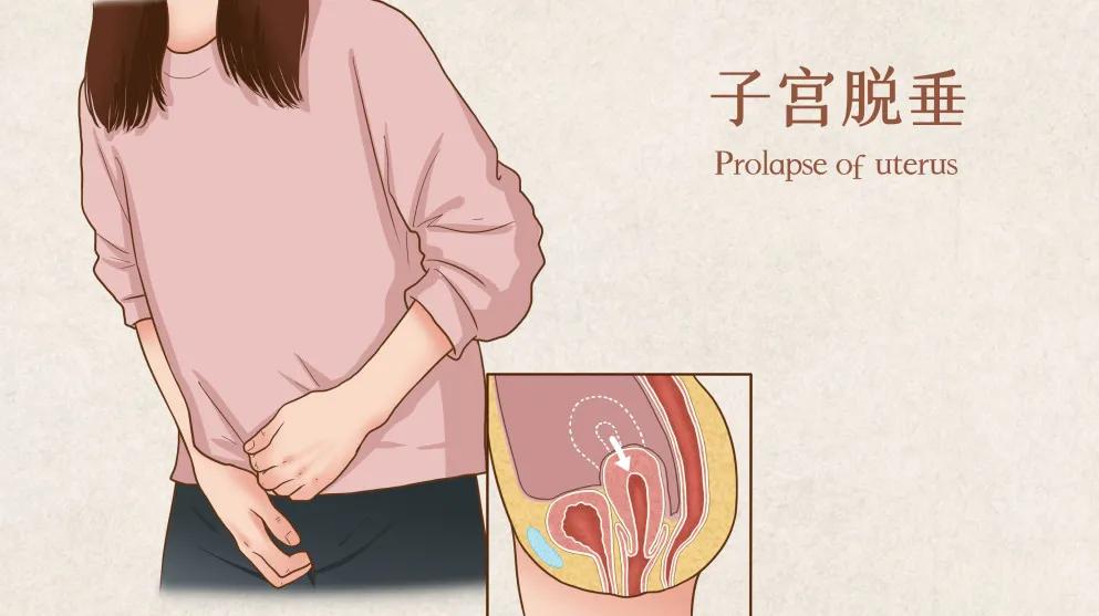 八旬老人下半身掉出一块肉，多种疾病缠身不能手术怎么办？