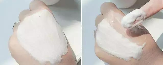 严重的红血丝泛红怎么治疗,红血丝泛红是因为什么