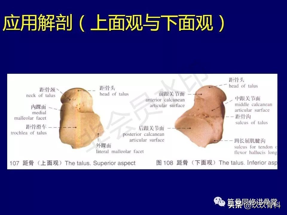 距骨骨折的治疗原则,距骨骨折如何调理