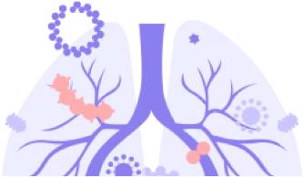 戴口罩时眼镜起雾的解决方法,眼镜起雾戴口罩怎么办