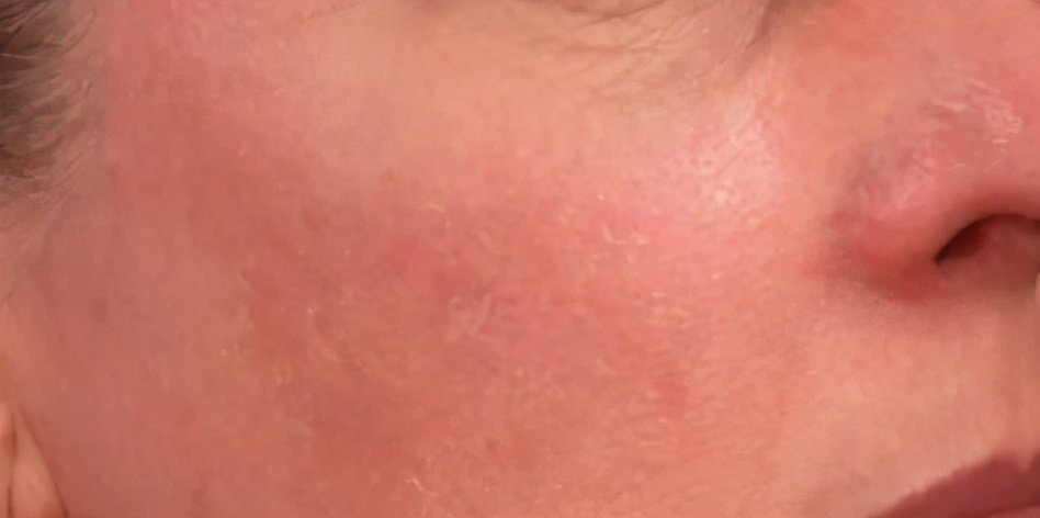 a醇到底好不好用,细说a醇