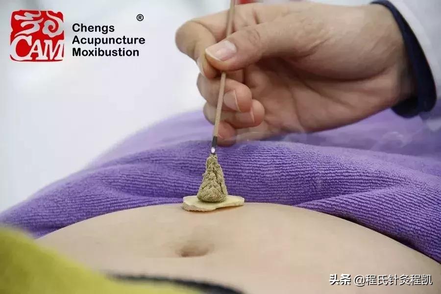 关于艾灸的那些事,答疑解惑揭秘
