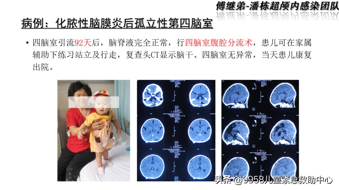 颅内感染康复治疗知识,小儿颅内感染的健康宣教
