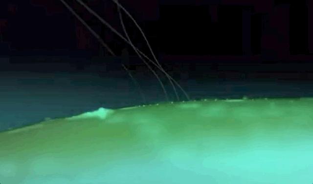 马斯克脑机接口新突破成功植入,脑后插管马斯克