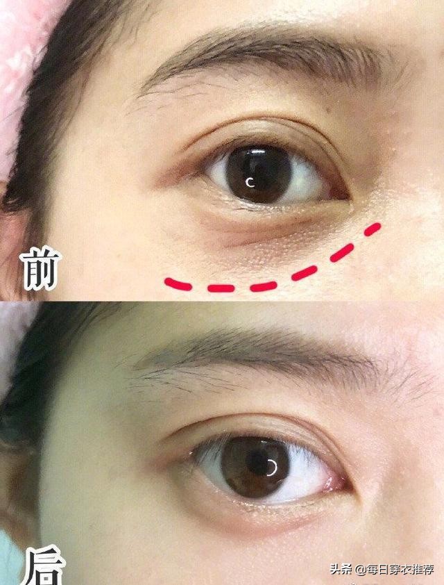 用了多年的眼霜,用过最好的眼霜