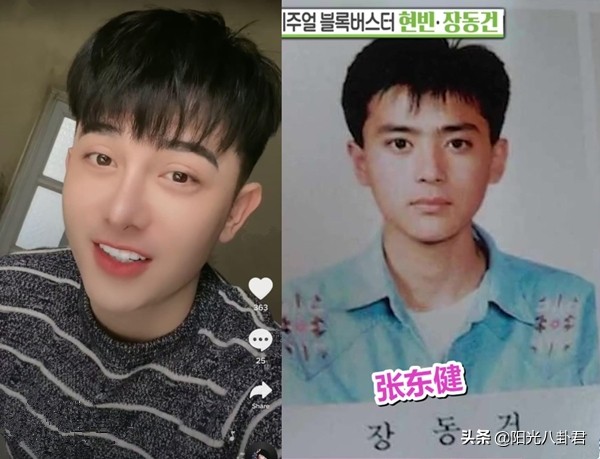 丑男整容变帅哥前后对比,丑男整容变帅哥对比照