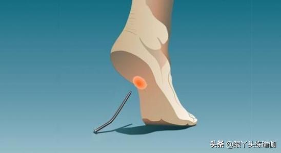 足底筋膜炎有哪些锻炼方法,瑜伽治疗足底筋膜炎