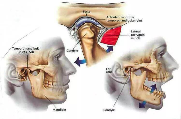 颞下颌关节紊乱是掉下巴么,颞下颌关节紊乱治疗费用大概多少