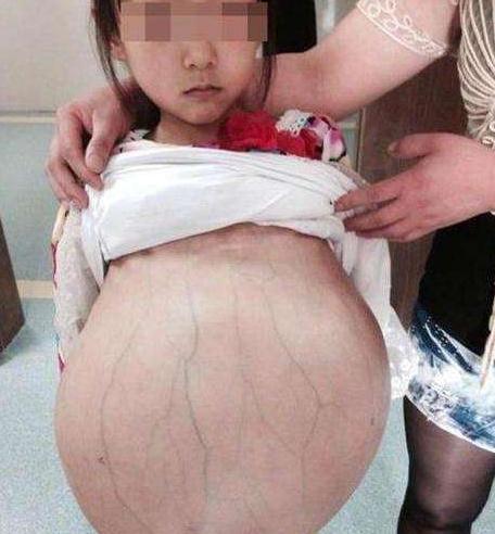 9岁女儿总是说肚子疼是怎么回事,18岁孩子胃疼是不是胃炎啊