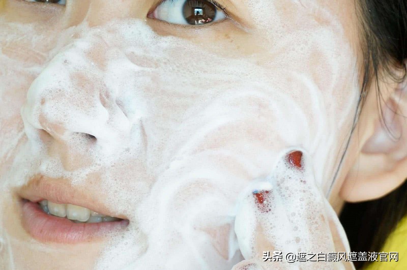 白癜风洗脸有什么忌讳,白癜风怎么清洁
