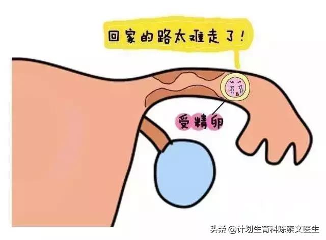 你是癌症的高危人群吗,宫外孕有哪些高发性群体