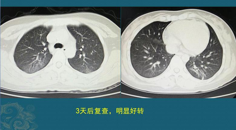 溺水后需要注意哪些事项,夏季溺水怎样防控