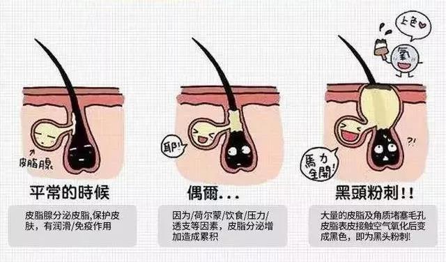 脸皮薄用什么护肤品最好,健康洗脸必备神器