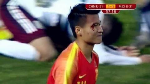 涓浗瓒崇悆灏忓皢鐣欐磱鐨囬┈,涓浗鐣欐磱鐞冨憳鐨囬┈