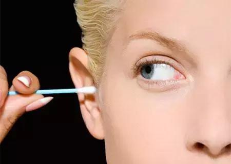 掏耳朵收费,掏耳要多少钱