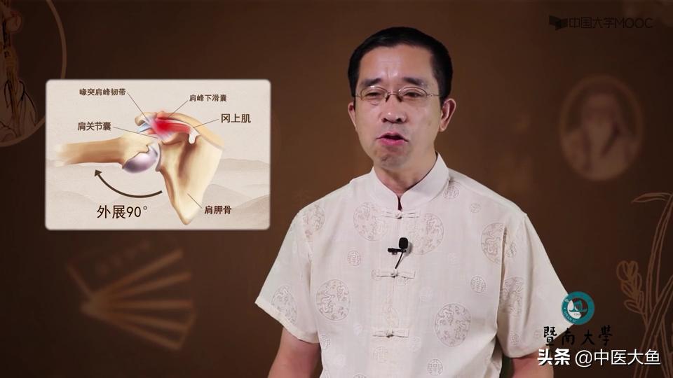 冈上肌腱炎的体征,冈上肌肌腱炎的症状及治疗