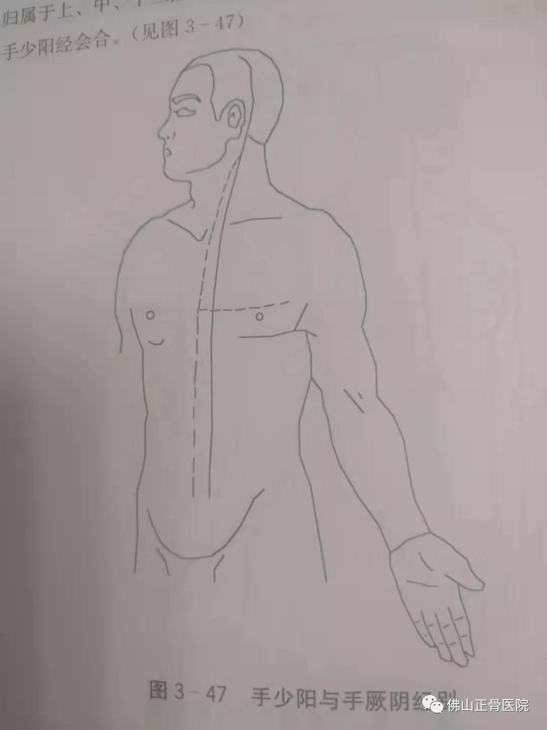 经筋手法，我院名誉院长国医大师韦贵康《韦氏骨伤手法集成》