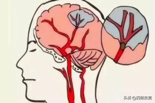 身体发热体温正常和发热有区别吗,人体发热有什么征兆