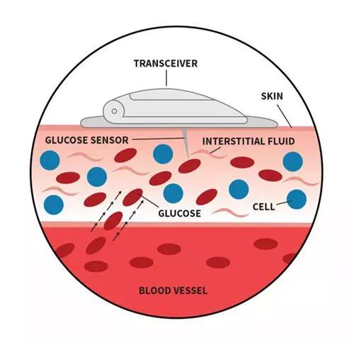 高壁垒高集中，资本和龙头纷纷布局的CGM赛道|行研