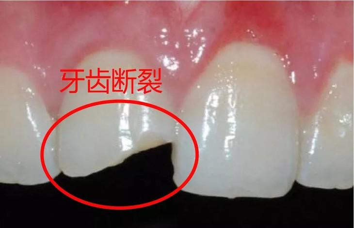 牙痛怎么办早期三大症状,请说出牙痛九个诱因