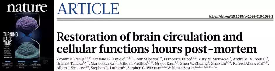 死亡为什么叫脑死亡,脑死亡是什么意义上的死亡