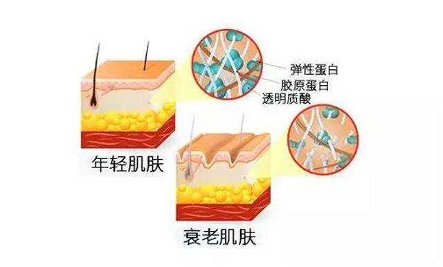 男人额头除皱用哪种方法好,额头除皱效果最好的方法