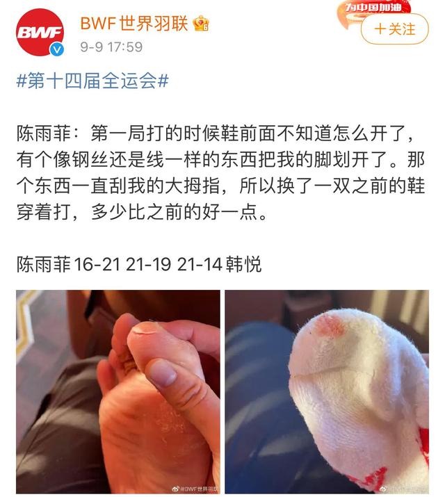 陈雨菲被李宁球鞋划伤,陈雨菲脚被鞋子割伤是什么原因