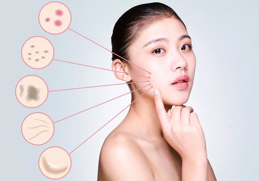 果酸换肤美白的方法,果酸换肤可以改善皮肤衰老吗