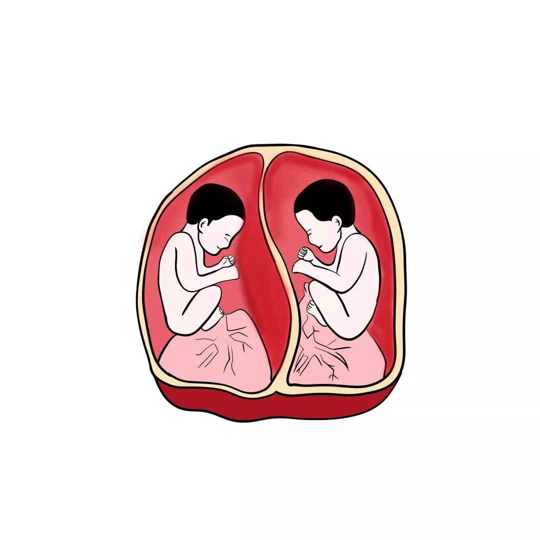 双胞胎孕妇大揭秘,双胞胎的深度解析