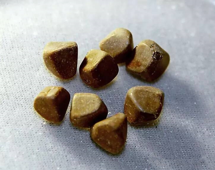 春天为什么胆结石会发作,胆结石疼痛一招解决