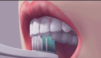 一张“示意图”告诉你，牙不好是怎样连累心血管的…