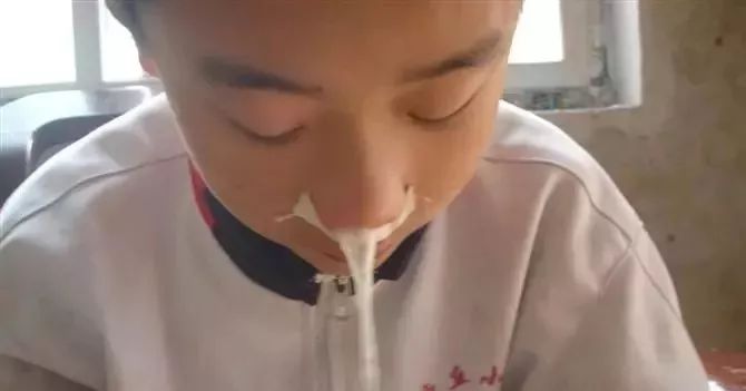 儿童鼻痒鼻塞鼻炎用什么喷剂,小孩鼻塞建议用什么鼻喷雾剂