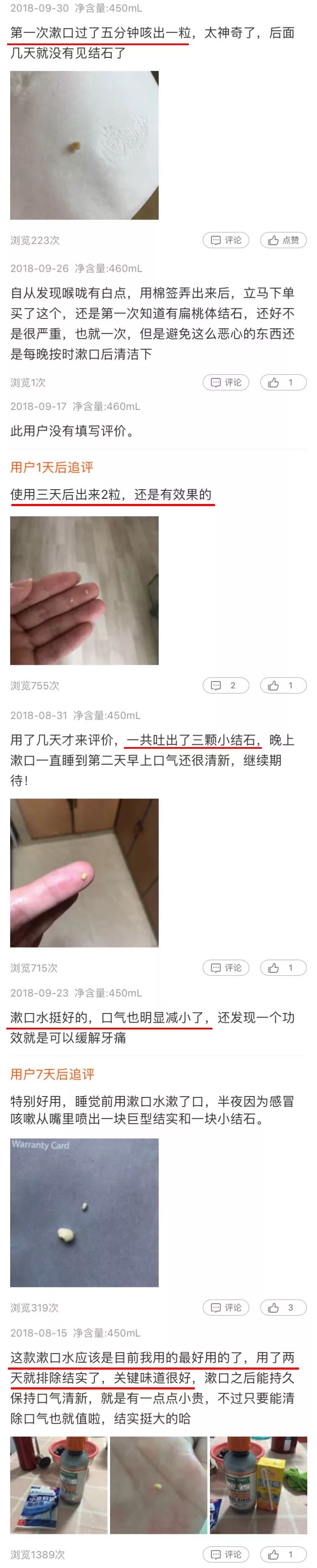 种草鸡丨惊呆了！30秒漱出扁桃体结石！