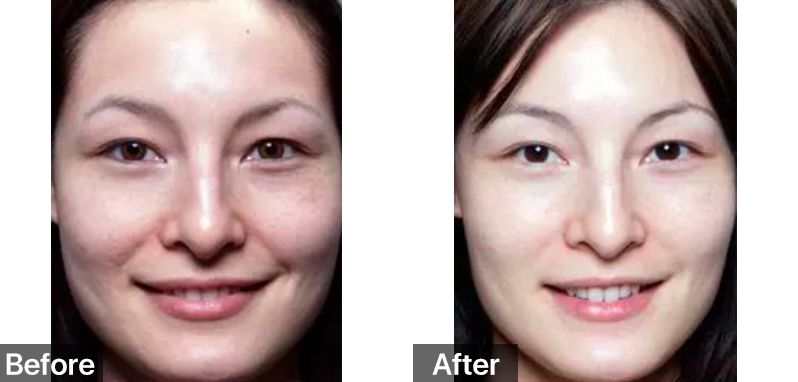 女星秒变“网瘾少女”，3C病“瘾”斑出击，失去远比看到得多