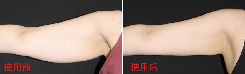 排油减脂抗糖解油腻,吸油刮油减肥法