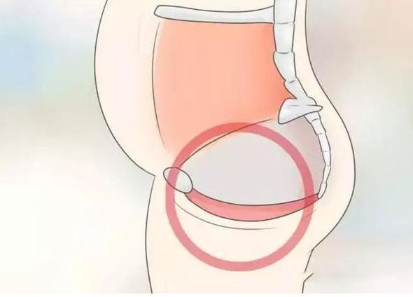 ella自曝产后抑郁,ella生育后遗症微博截图