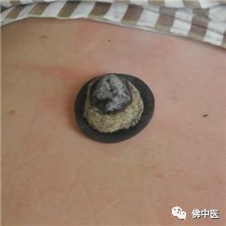 「传统医药日」秋冬预防季节性疾病，巧用艾条“自灸”益处多