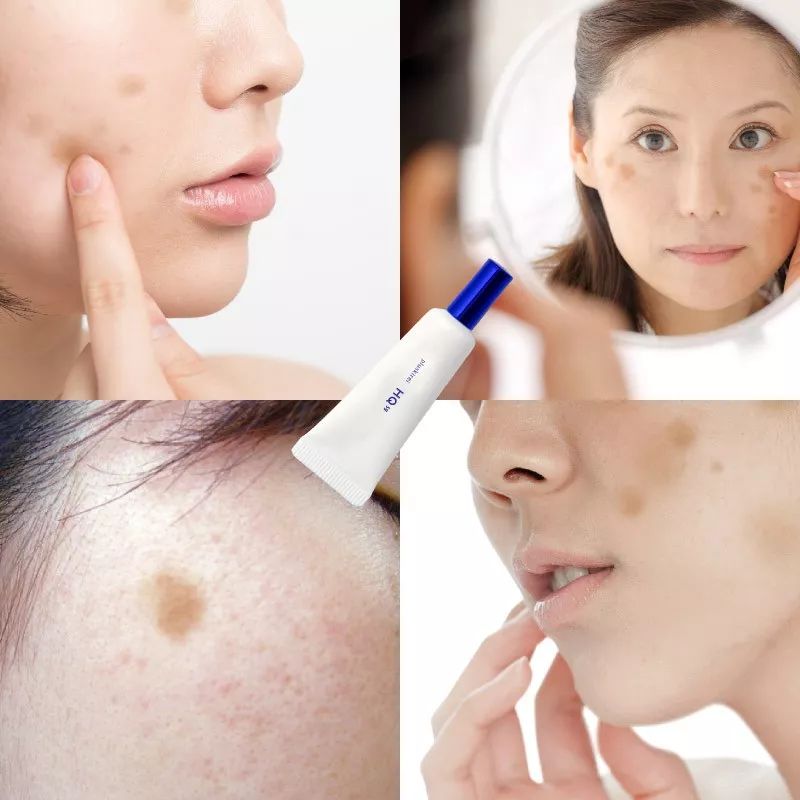 来自日本的HQ祛斑霜,一月一支,淡斑抗皱,让肤色重回净白透亮