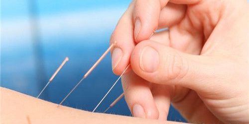 针灸可以瘦手臂和大腿吗,瘦手臂针灸效果怎么样